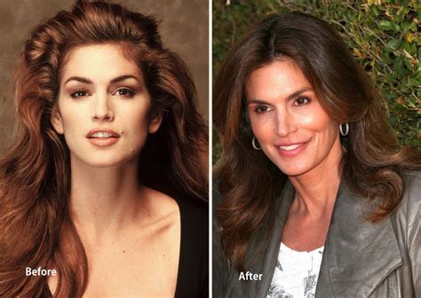 cindy crawford nose|Cindy Crawford: My 11 years of cosmetic surgery